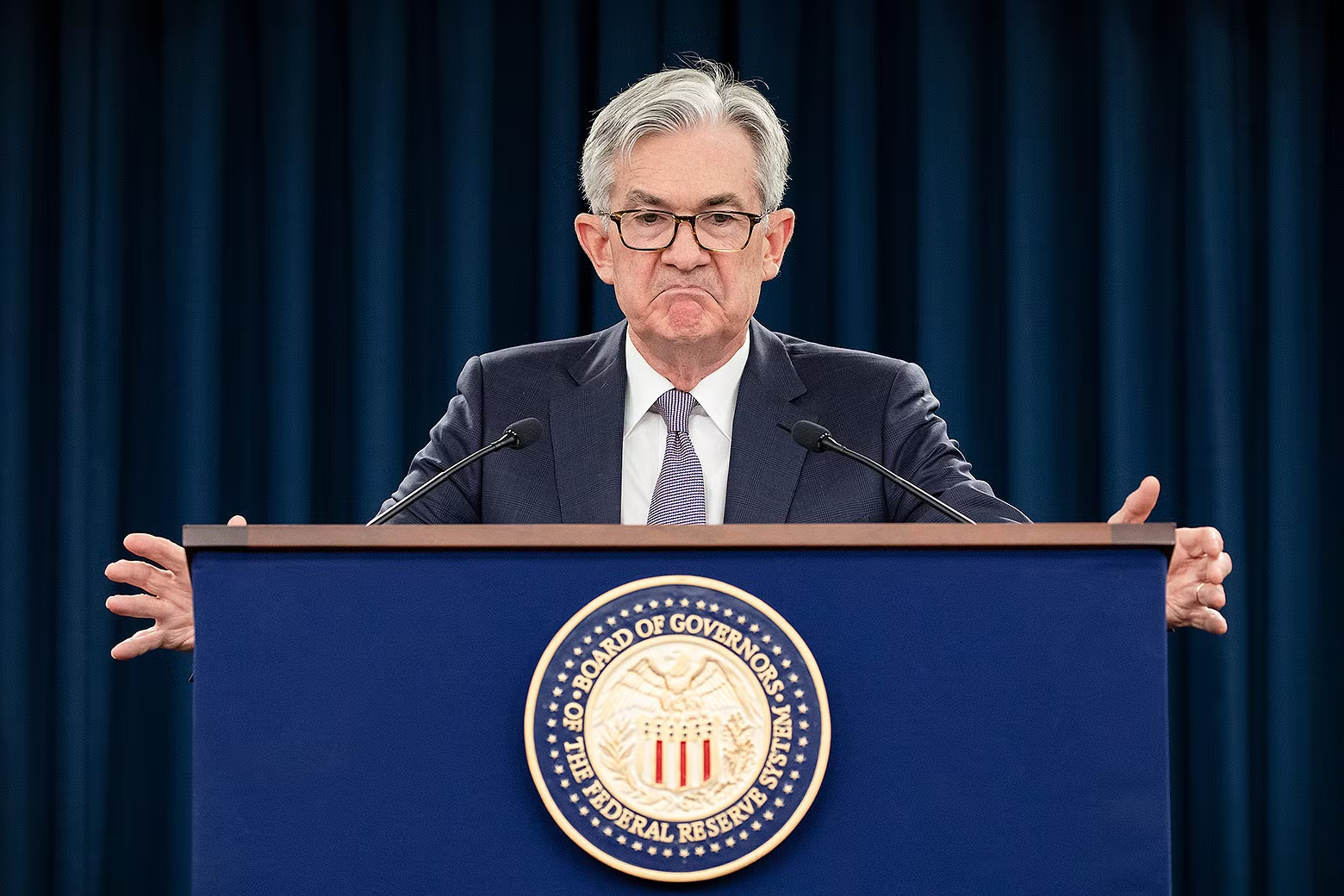 Why might the Federal Reserve cause a recession to fight inflation? Unanchored expectations.